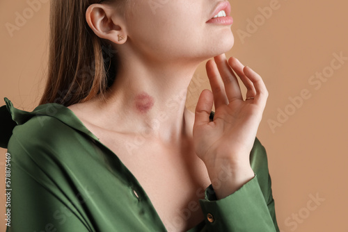 Young woman with love bite on her neck against color background, closeup