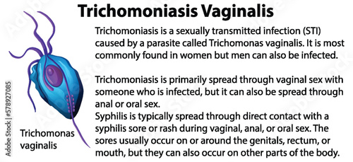 Trichomoniasis Vaginalis with explanation photo