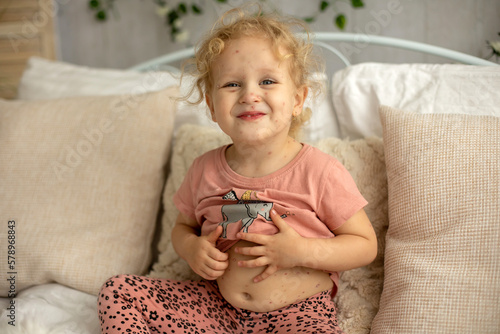Fotografie Little toddler girl with chicken pox in bed, playing at home, quarantine isolati