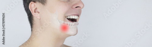 Schematic representation of pain in the jaw. Augmented reality. An x-ray of the jaw bone superimposed on a photograph. Painful areas are highlighted in red. Human bone disease. Osteomyelitis photo