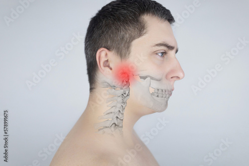 Schematic representation of pain in the jaw. Augmented reality. An x-ray of the jaw bone superimposed on a photograph. Painful areas are highlighted in red. Human bone disease. Osteomyelitis photo