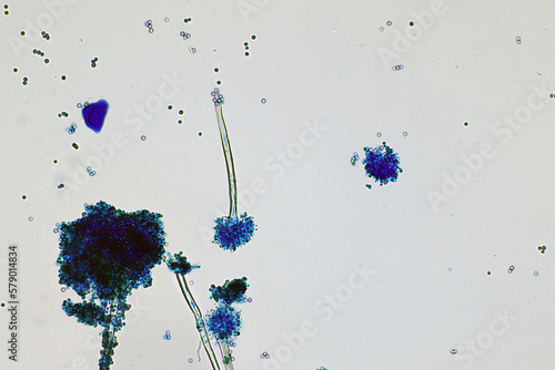 Microscope of black fungus spore strain with Lactophenol cotton blue, molds or yeasts with macro 40x lens, contamination in air room, pollution aerosol environmental. Microbiology laboratory concepts.