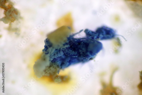 Microplastics inside the soil observed under a 40x microscope macro lens in an environmental health laboratory. This image represents non-recyclable plastic particles contaminating agricultural soil. 