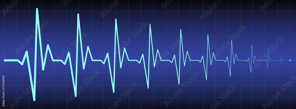ecg, ekg monitor with cardio diagnosis illustration. Heart rhythm line vector design to use in healthcare, healthy lifestyle, medicine, ekg, ecg concept illustration projects. 