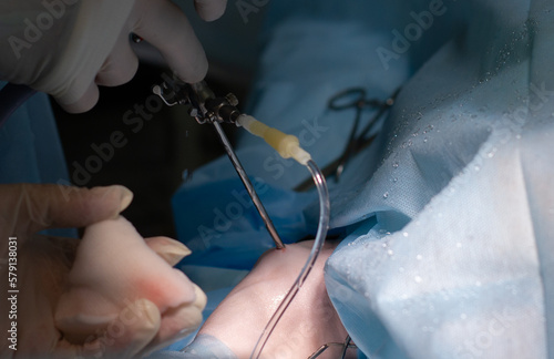 Port in the dog's knee during joint arthroscopy. In a veterinary clinic, a joint is checked by arthroscopy in a pet with chromate. The concept of orthopedics and arthroscopy in veterinary medicine.