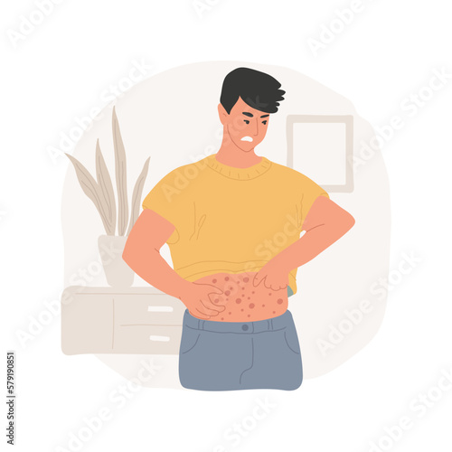 Scabies isolated cartoon vector illustration. Man with red dots on a belly and hands scratching himself, lack of body hygiene, skin allergy, dermatitis and scabies problems vector cartoon.