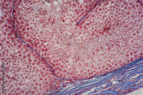Anatomy and Histological Uterine tube, Uterus, Vagina, Ovary and Testis Rabbit cells under microscope. photo
