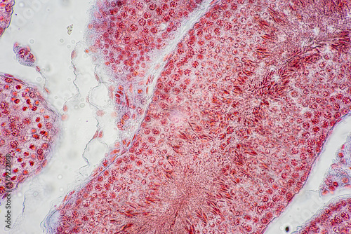 Anatomy and Histological Uterine tube, Uterus, Vagina, Ovary and Testis Rabbit cells under microscope. photo