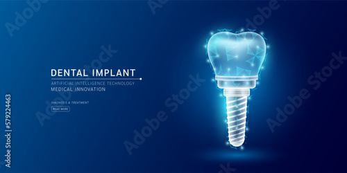 Website template. Dental implant translucent low poly triangles. Futuristic glowing human tooth organ hologram on dark blue background. Medical innovation diagnosis treatment concept. Banner vector.