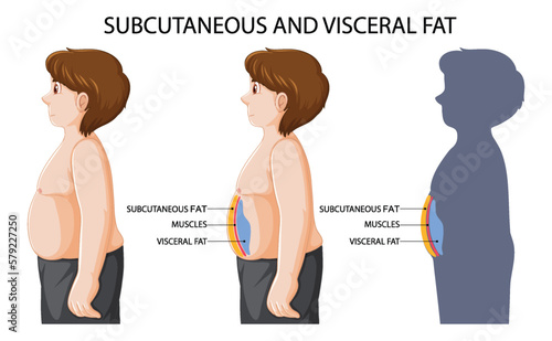 Subcutaneous and visceral fat diagram