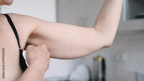 Mature woman with flabby arm skin, hand fat problem