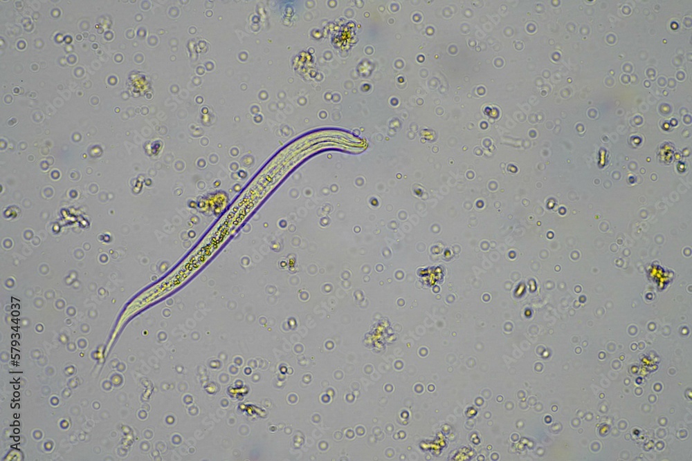 insect parasite in the soil in australia under the microscope Stock ...