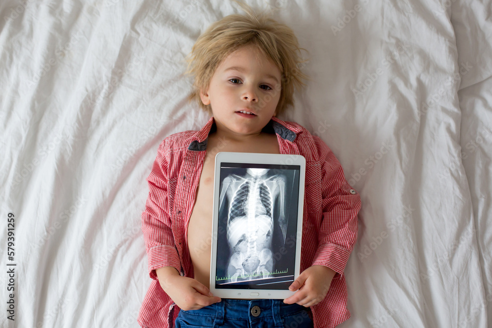 Toddler child, holding xray picture on tablet of child body with