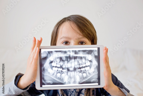Child, preteen boy, holding tablet with a picture of his x-ray teeth photo