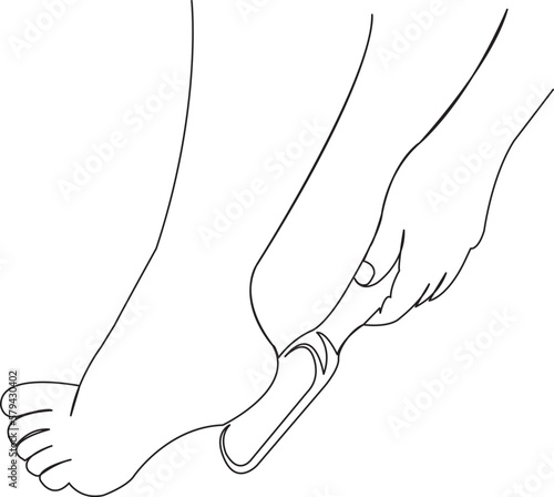 treats heels with