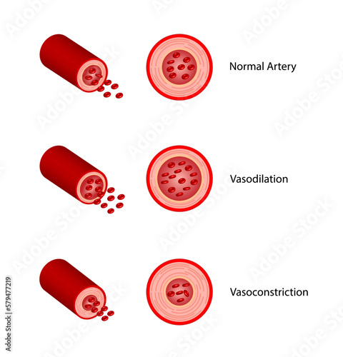 Arterial vasoconstriction and vasodilation. Cross section of arteries. Comparison of normal, constricted, and dilated blood vessels. Scientific Diagram. Vector illustration.