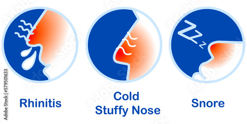 Rhinitis Cold Stuffy Nose Snore, Runny nose icon isolated . Rhinitis symptoms, treatment. Nose and sneezing. Nasal diseases. Vector Illustration