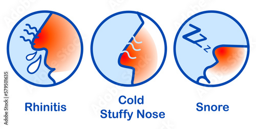 Rhinitis Cold Stuffy Nose Snore, Runny nose icon isolated . Rhinitis symptoms, treatment. Nose and sneezing. Nasal diseases. Vector Illustration photo