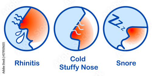 Rhinitis Cold Stuffy Nose Snore, Runny nose icon isolated . Rhinitis symptoms, treatment. Nose and sneezing. Nasal diseases. Vector Illustration