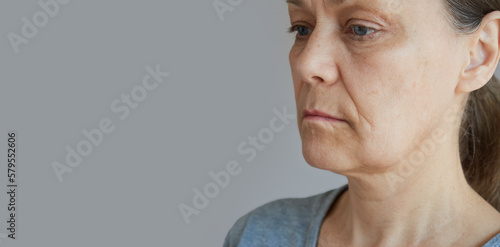 Profile of the face of a mature woman with a swelling on her cheek, with a toothache. Copy space image © evafesenuk