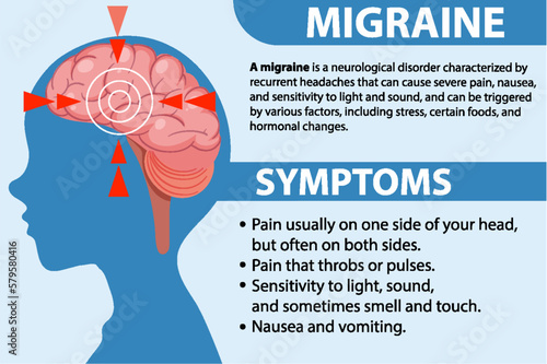 Informative poster of Migraine