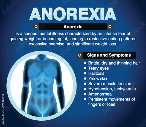 Informative poster of Anorexia eating disorder