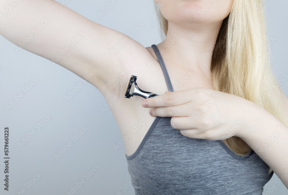 Armpit rash. Underarm skin irritation. Blonde girl shows irritation on