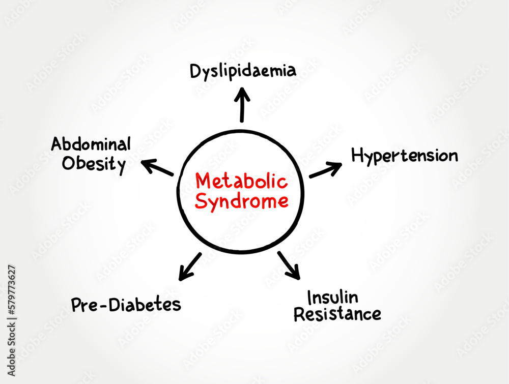 Metabolic Syndrome mind map process, medical concept for presentations and reports Metabolic Syndrome mind map process, medical concept for presentations and reports