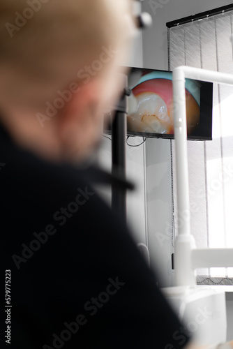 Dentistry dentist looks at the patient's teeth on the screen