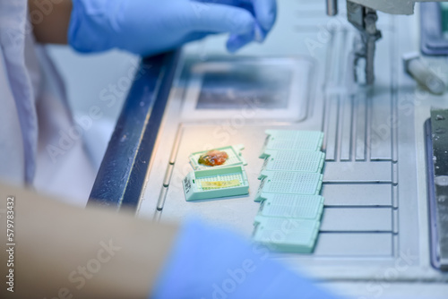 Tableau sur toile A pathologist is preparing a pathological biopsy for laboratory diagnosis of pathology