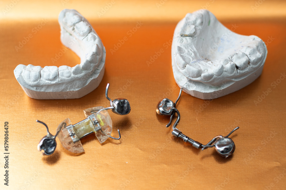 Dental casting gypsum model plaster cast stomatologic human jaws