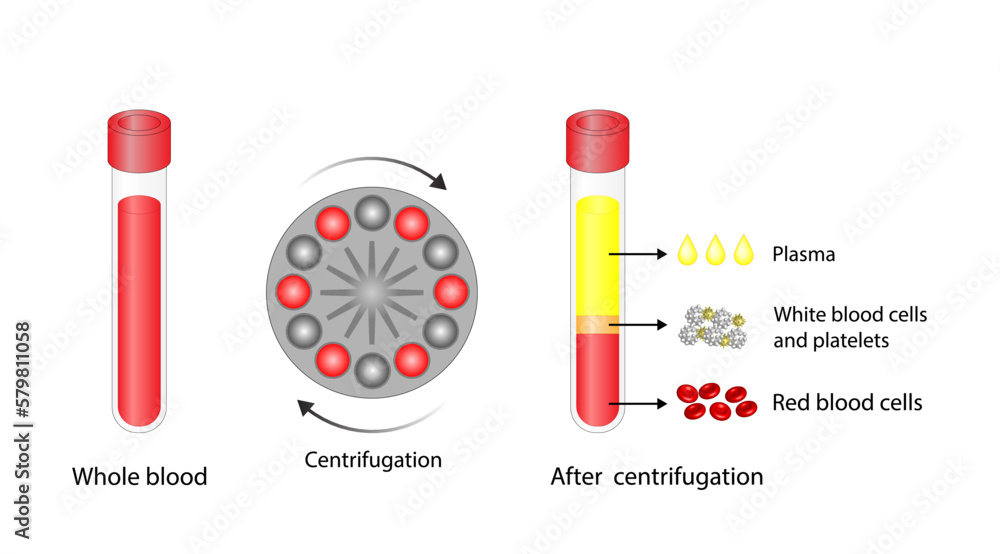 Blood centrifugation. Platelets, red blood (erythrocytes) and white