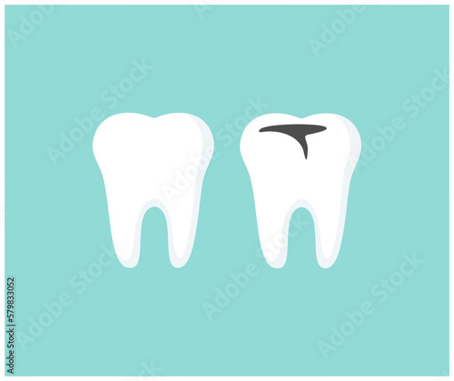Shiny, healthy tooth and tooth with decay logo design. Concept dentistry, dental treatment, correction of occlusal, oral care, caries prevention vector design and illustration.