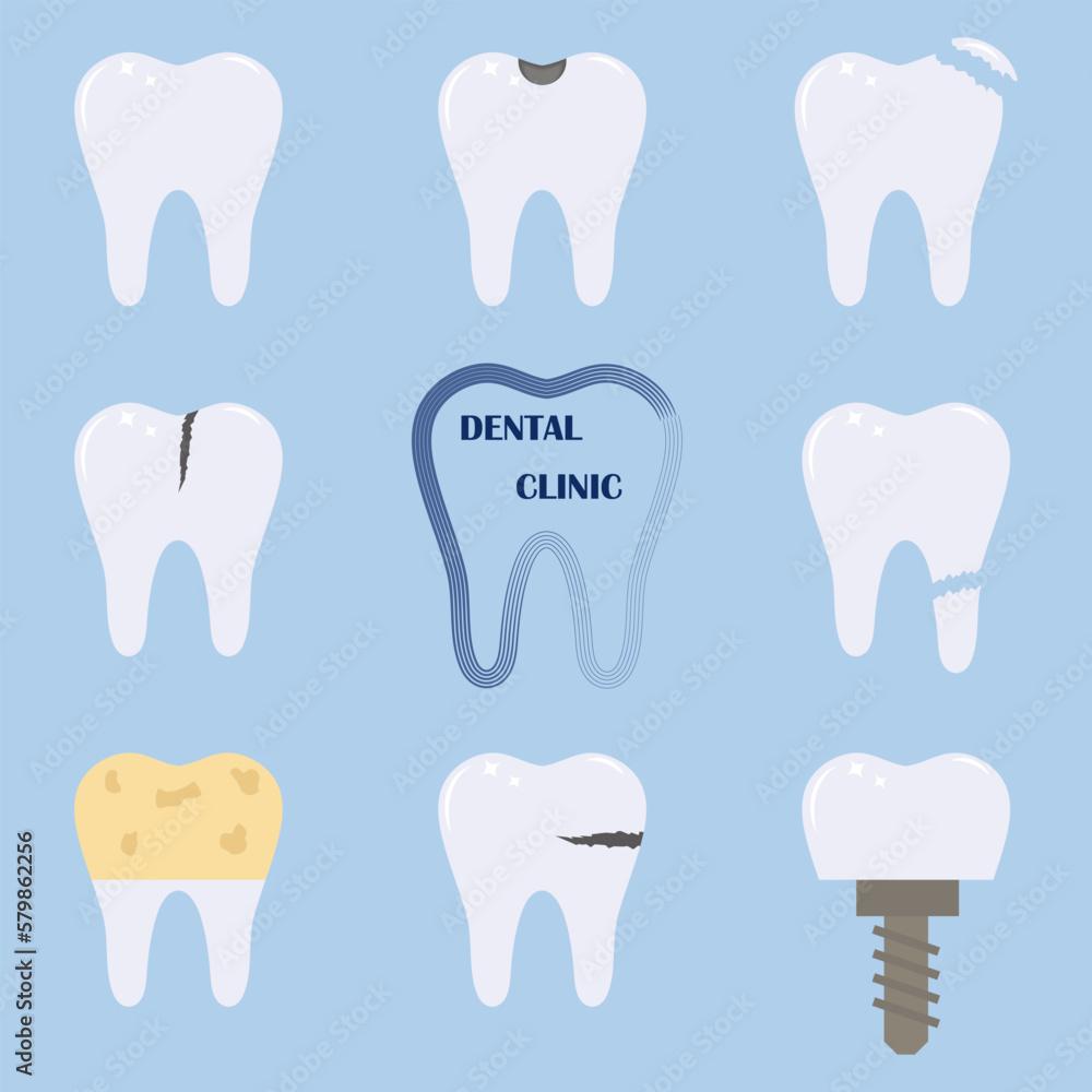 A set of teeth with various injuries. Healthy and diseased tooth, caries, broken root, plaque, stains, cracks. Banner, poster for printing. A set of teeth with various injuries. Healthy and diseased tooth, caries, broken root, plaque, stains, cracks. Banner, poster for printing.