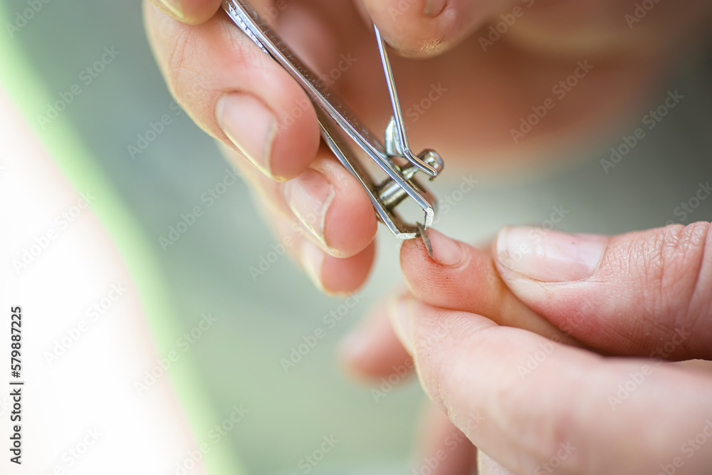 Nail care. Hygiene and manicure for children. A single mother cuts off her daughter's Ugly dirty nails. Nail care. Hygiene and manicure for children. A single mother cuts off her daughter's Ugly dirty nails.