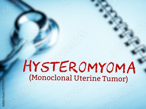 Hysteromyoma medical term, monoclonal uterine tumor, selective focus. photo