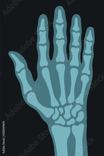 X ray right human hand ultra skeleton body bone roentgen front view vector flat illustration