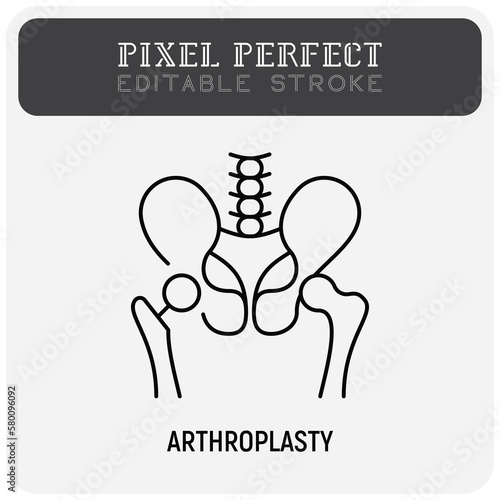 Arthroplasty thin line icon, artificial joint, surgical procedure to restore joint. Arthritis. Pixel perfect, editable stroke. Vector illustration.