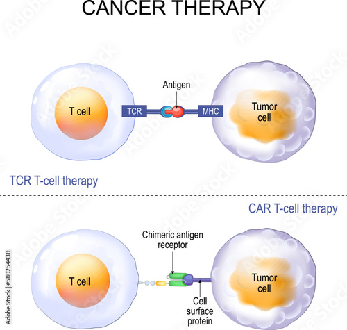 T-cell therapy with T-cell receptor (TCR) or Chimeric antigen receptor (CAR).