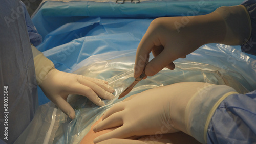 фотографія The surgeon makes an incision with a scalpel on the girl's stomach