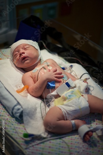 sick newborn baby in hospital NICU with monitoring equipment for brain injury at birth 