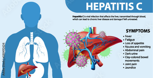 Informative Symptoms of Hepatitis C