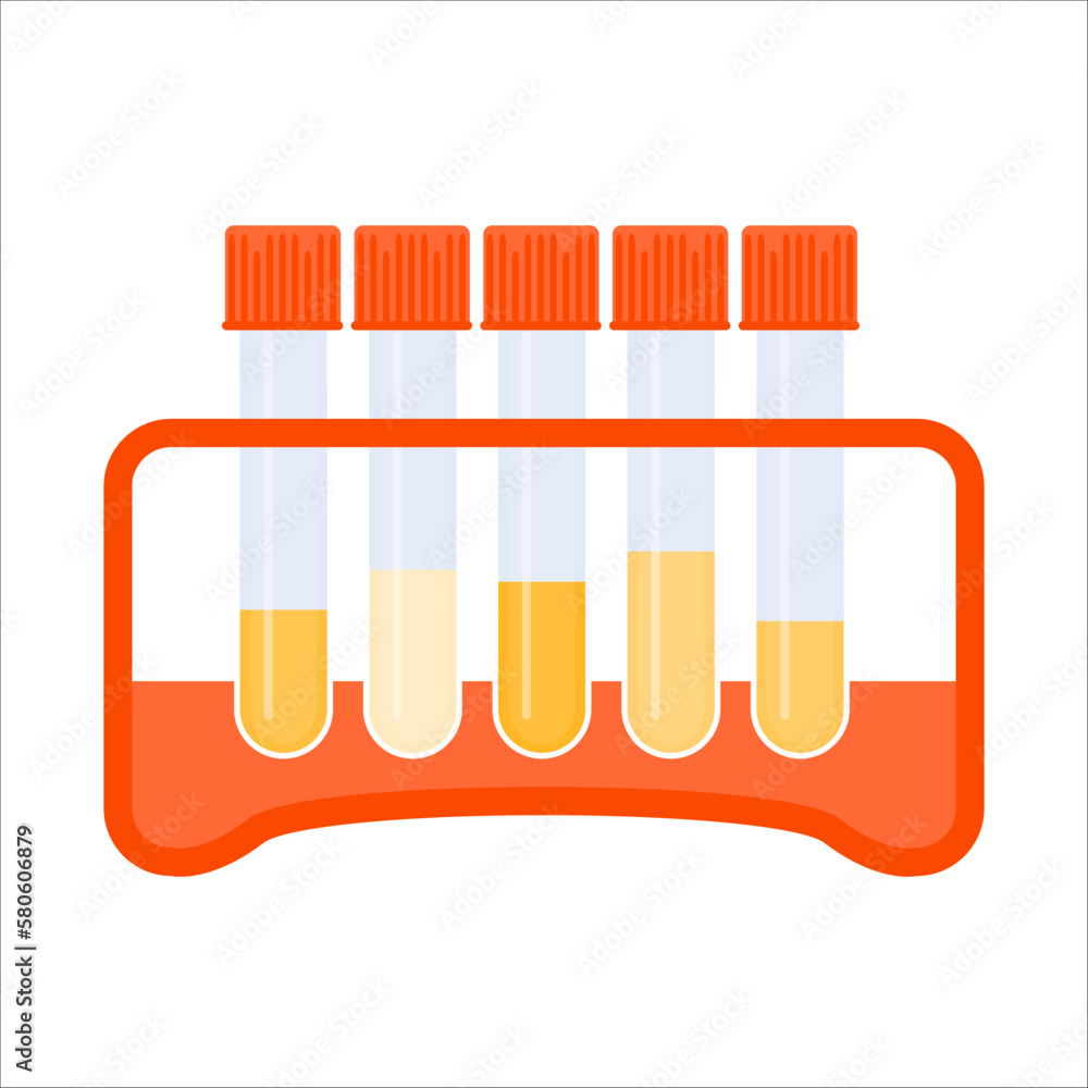 Urine sample rack with test tubes showing dehydration level. Yellow