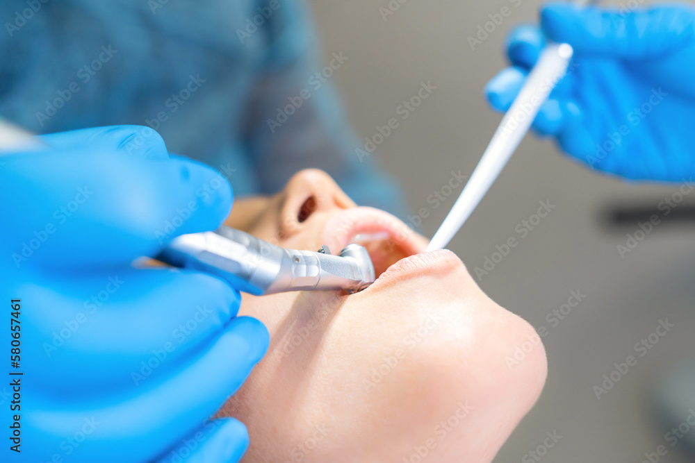 Naklejka premium Closeup photo of male dentist with female patient in dental chair providing oral cavity treatment.