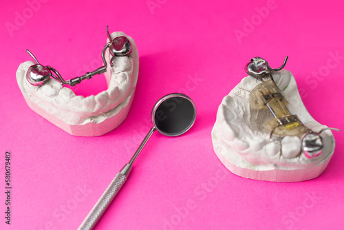Dental models top view. Jaw models with different problems. Treatment of dental diseases concept. Plaster models of human teeth. Visual aid for training of dentists or orthodontists. Dental inventory