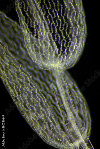 Microscopic view of peat moss (Sphagnum) detail. Darkfield illumination.
