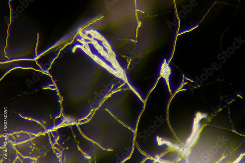 Microscopic view of a mold (Penicillium) and its spores on conidiophores. Darkfield illumination. photo