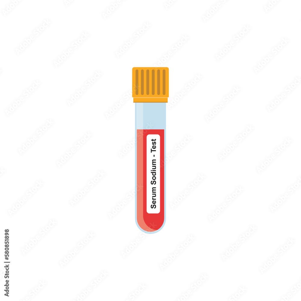Serum Sodium Blood Test Concept Design. Vector Illustration. Serum Sodium Blood Test Concept Design. Vector Illustration.