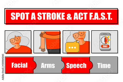 Cerebrovascular disease or stroke signs and symptoms.