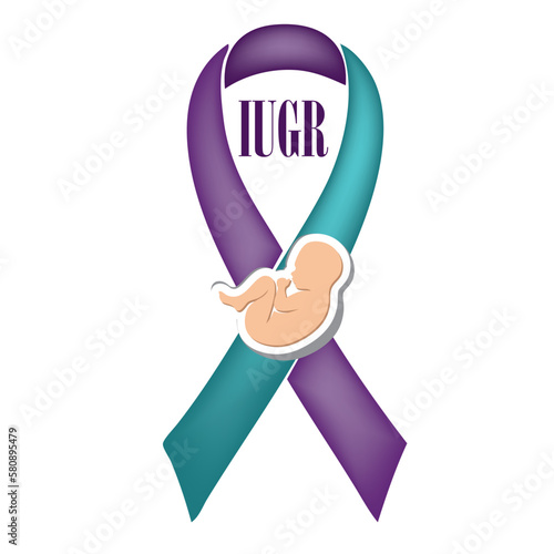 Ribbon for IUGR Awareness